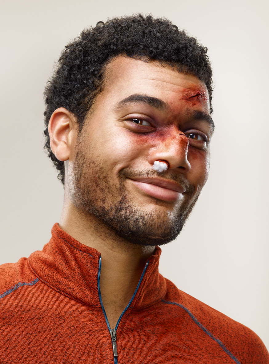 Man with injuries to the face | Conceptual Portrait by Saverio Truglia